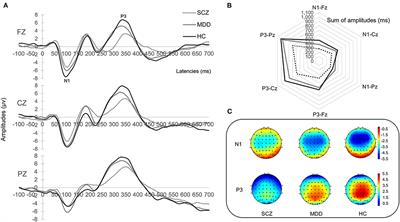 Machine Learning-Based Electroencephalographic Phenotypes of Schizophrenia and Major Depressive Disorder